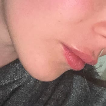 Genosys BBC Güneş Kremi Ciddi Yanma Ve Kızarıklık Oluşturdu