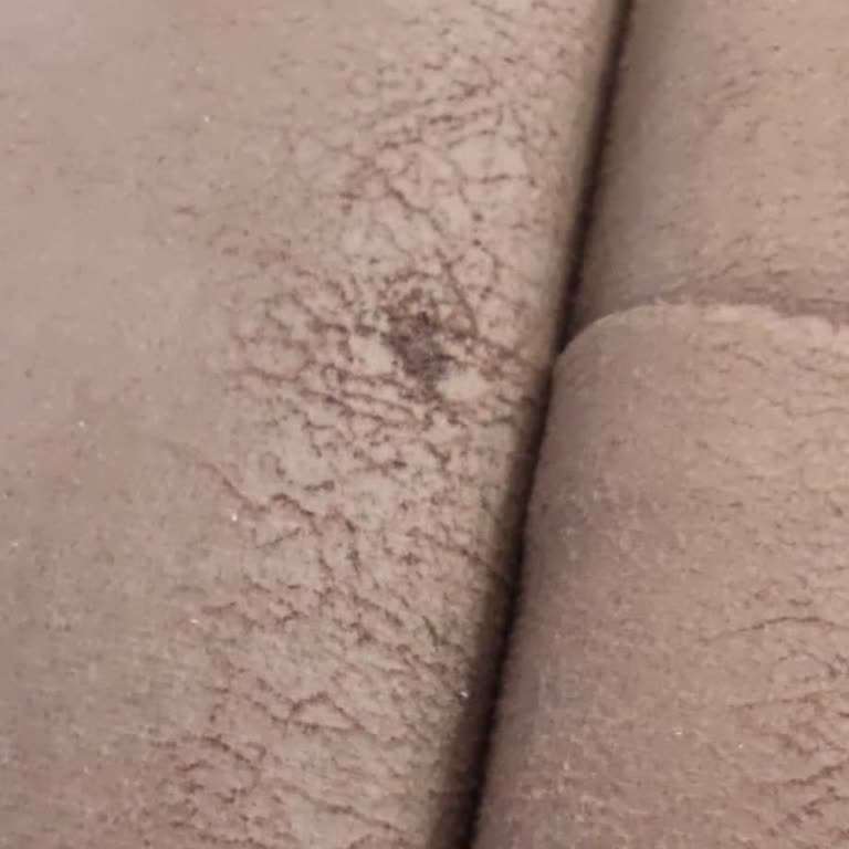 Chester Koltuğumuzun Aşınma Sorunu Ve İlgisiz Servis