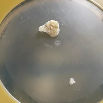 Nestle Bebek Sütünde Şaşırtıcı Yabancı Madde