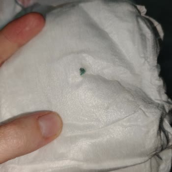 Bebek Bezinde Güvenlik Sorunu