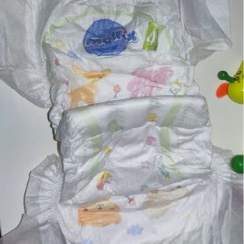 Molfix Pure Soft Bezlerde Güvenlik Endişesi: Yabancı Madde Sorunu