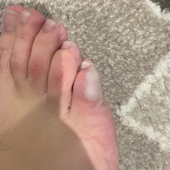 Waterproof Özelliği Olmayan Askeri Bot Sorunu