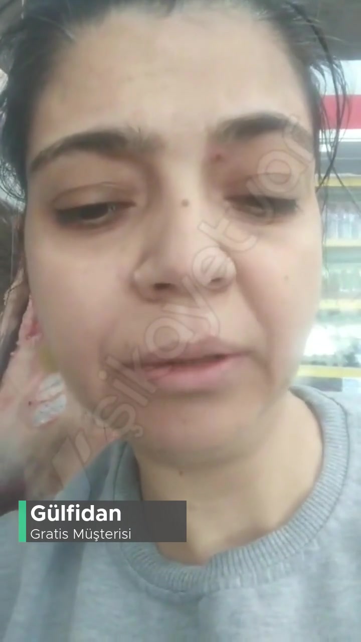 Gratis İndirimli Aldığım Ürünü Göndermiyor videonun kapak resmi