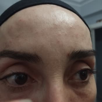 Yanlış İşlemler Ve İlgisizlikle Hayal Kırıklığı