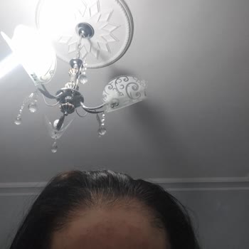 Yanlış İşlemler Ve İlgisizlikle Hayal Kırıklığı