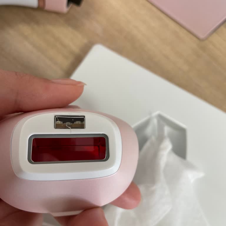 Philips Servisinde Parça Bekleme Çilesi