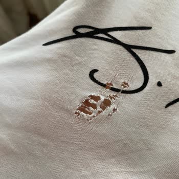 Leke Çıkarıcı Kıyafetimi Yırttı!