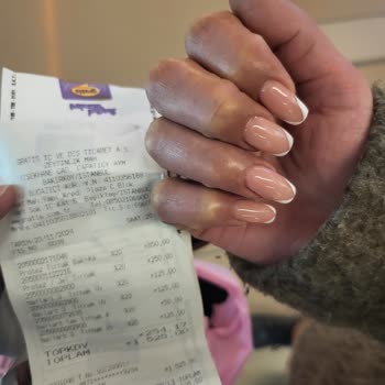 Protez Bakımında Beklenmedik Ücret Şoku