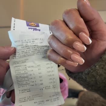 Protez Bakımında Beklenmedik Ücret Şoku