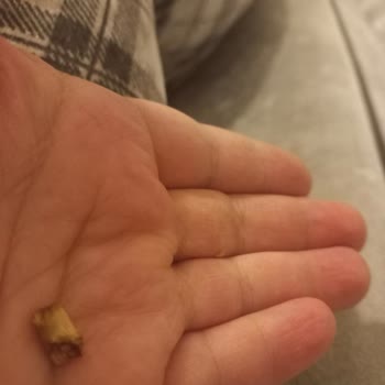 Eti Çikolata İçerisinden Çıkan Sert Madde Şoku