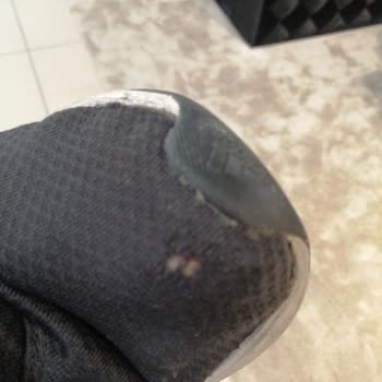 Adidas Ayakkabıda 3 Ayda Delinme Ve Astar Yırtılması Şoku