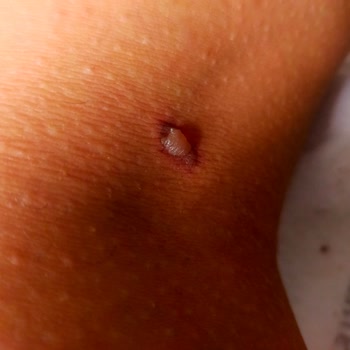 The Liv Güzellik & Estetik İstanbul Mağduriyeti