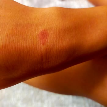 The Liv Güzellik & Estetik İstanbul Mağduriyeti