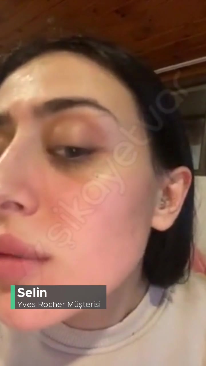 Yves Rocher Yüzümü Berbat Etti, Tüketici Hakları'na Gideceğim! videonun kapak resmi