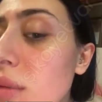 Yves Rocher Yüzümü Berbat Etti, Tüketici Hakları'na Gideceğim!