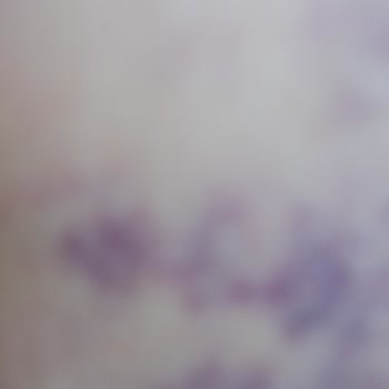 Worldtur Mağduriyeti