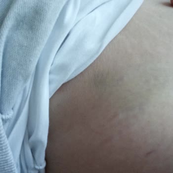 Worldtur Mağduriyeti