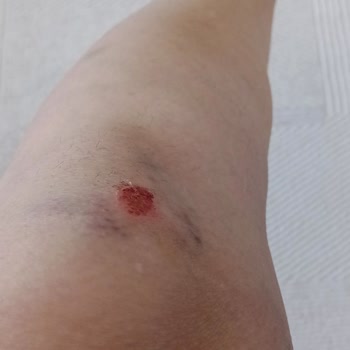 Worldtur Mağduriyeti