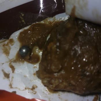 A101 Xxrol Çikolatadan Çıkan Yabancı Cisim