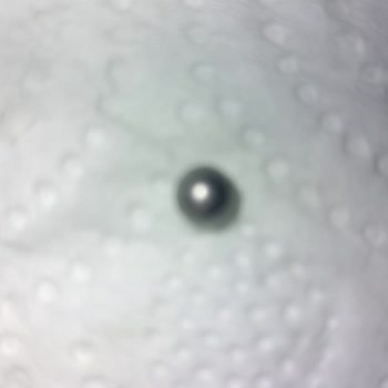 A101 Xxrol Çikolatadan Çıkan Yabancı Cisim