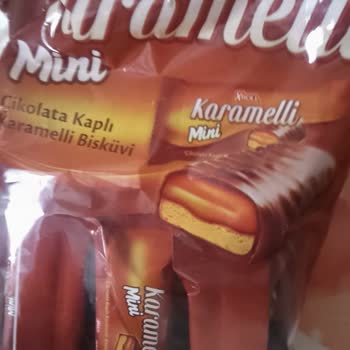 Çikolatadan Çıkan Tehlike: Dişim Kırıldı!