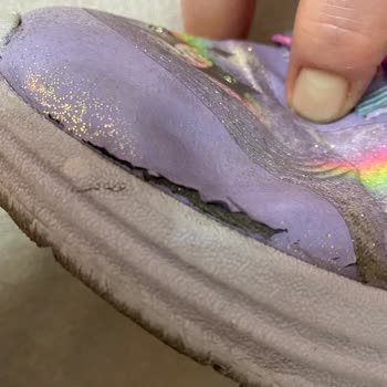 Skechers Müşteri Hizmetleri Ve Ürün Kalitesi Sorunu!