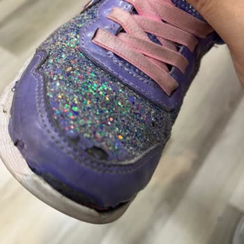 Skechers Ayakkabıda Kalite Sorunu