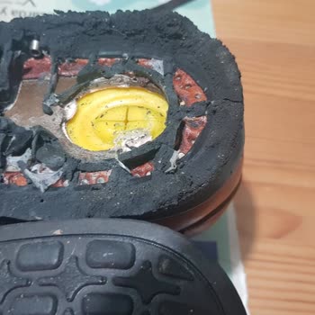 Forex Anatomic Ayakkabı Kalitesizliği