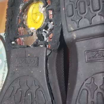 Forex Anatomic Ayakkabı Kalitesizliği