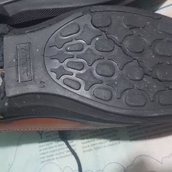 Forex Anatomic Ayakkabı Kalitesizliği