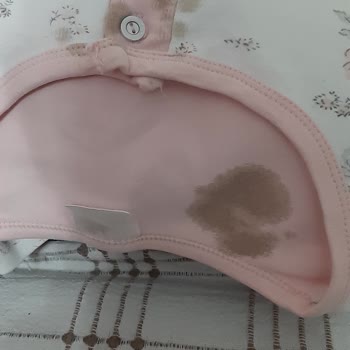 Valizde Yağ Lekesi Şoku