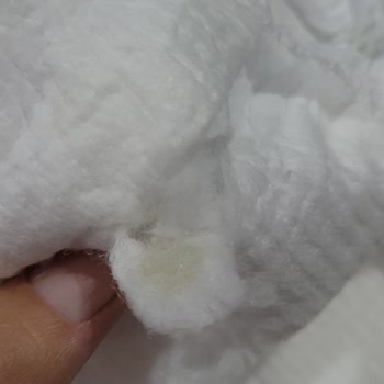 Molfix Bebek Bezi Sertlik Sorunu!