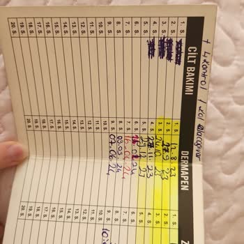 Lazer Epilasyon Sonrası 2. Derece Yanık Ve İz Kalma Endişesi