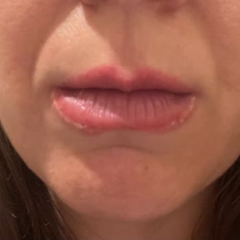 Dudak Renklendirmede Büyük Hayal Kırıklığı