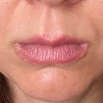 Dudak Renklendirmede Büyük Hayal Kırıklığı