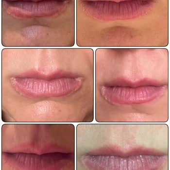 Dudak Renklendirmede Büyük Hayal Kırıklığı