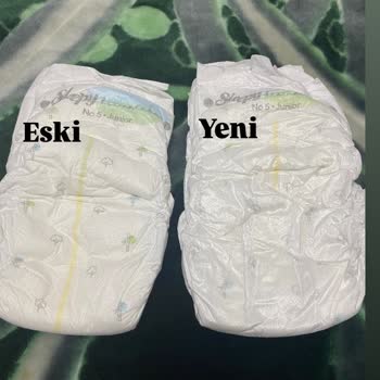Sleepy Bebek Bezi Kalite Sorunu Ve Mağduriyet