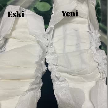 Sleepy Bebek Bezi Kalite Sorunu Ve Mağduriyet