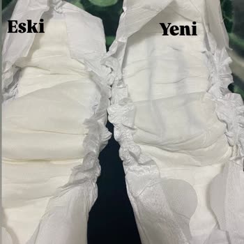 Sleepy Bebek Bezi Kalite Sorunu Ve Mağduriyet