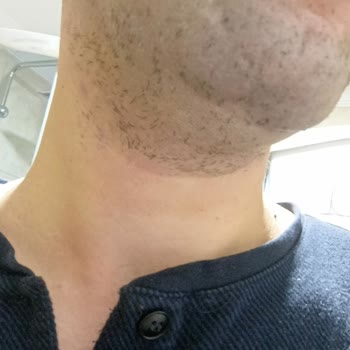 Philips Tıraş Makinesi Tıraş Performansı Sorunu