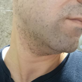 Philips Tıraş Makinesi Tıraş Performansı Sorunu