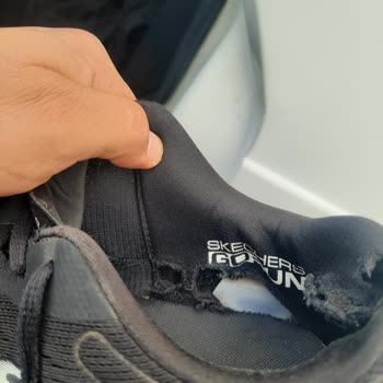 Skechers Ayakkabılarında Beklenmedik Deformasyon