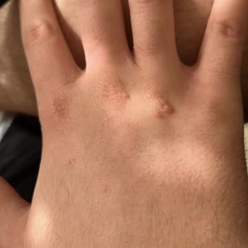 Doktor Yanlış Tedaviyle Hayal Kırıklığı Yaşattı