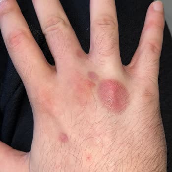 Doktor Yanlış Tedaviyle Hayal Kırıklığı Yaşattı