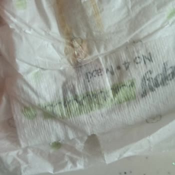 Bebek Bezinde Beklenmedik Sorun