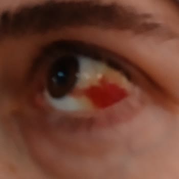Eki aç