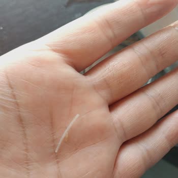 Derya Ton Balığı Konservesinde Tehlikeli Kılçık Sorunu