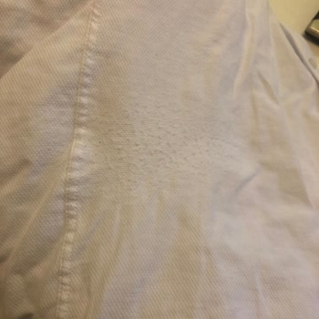 Pierre Cardin Gömlek Tüylenme Sorunu