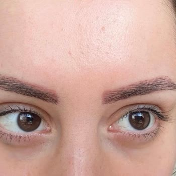 Kaş Pudralama İşlemi Hayal Kırıklığına Uğrattı