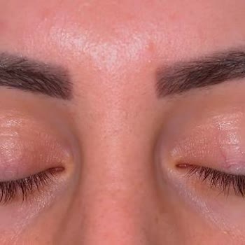 Kaş Pudralama İşlemi Hayal Kırıklığına Uğrattı